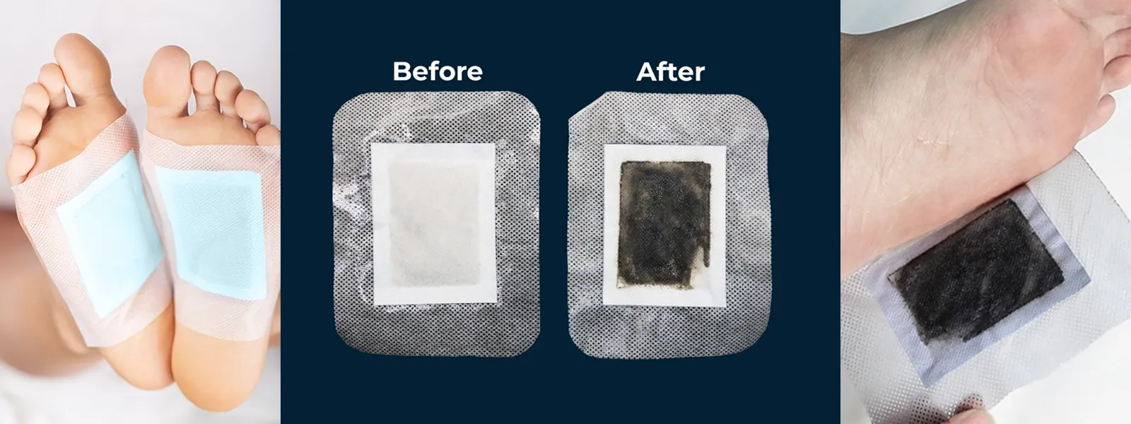 xitox-before-after